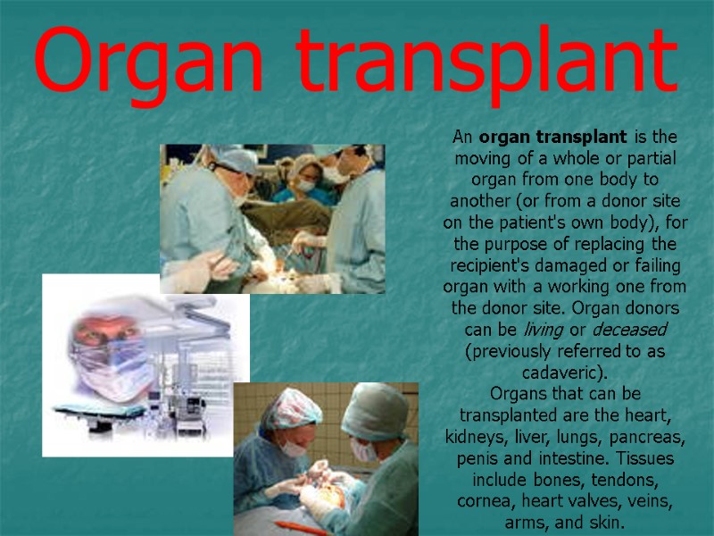 An organ transplant is the moving of a whole or partial organ from one